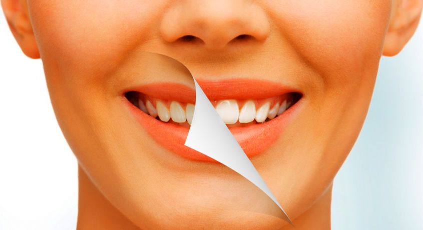 Здоровая и белоснежная улыбка весь год! Скидка 77% на ультразвуковую чистку зубов, отбеливание «Air Flow» и полировку зубов.