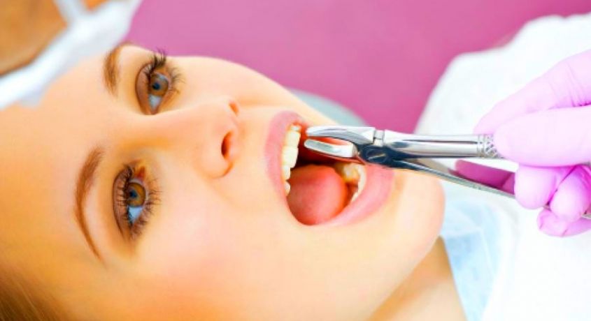 Жить без зубной боли! Скидка 60% на удаление постоянного зуба + инновационные коллагеновые материалы.