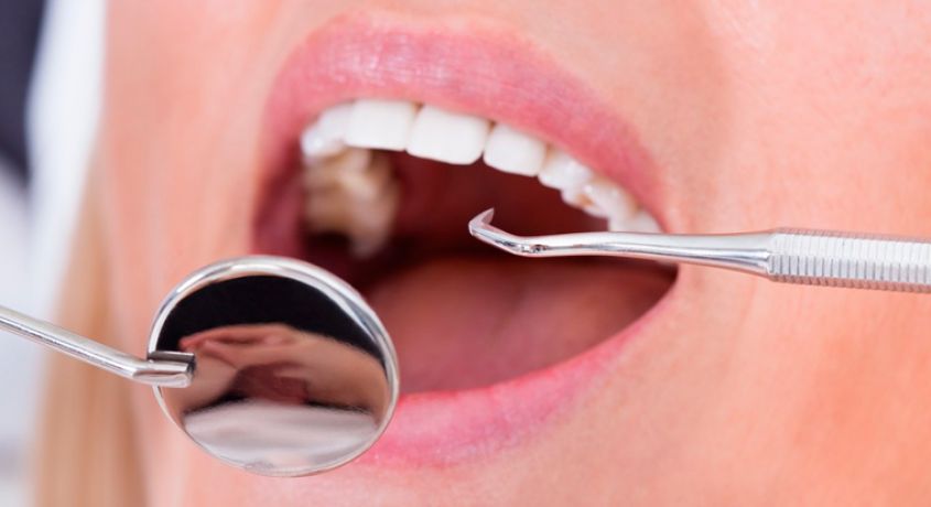 Здоровые зубы в подарок! Подарочные сертификаты со скидкой 50% от стоматологии «Здравия».