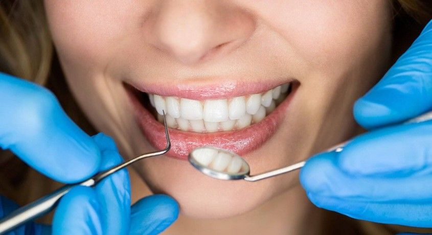 Скидка 50% на герметизацию фиссур и реминерализующую терапию в стоматологической клинике «Лэна-Дент».
