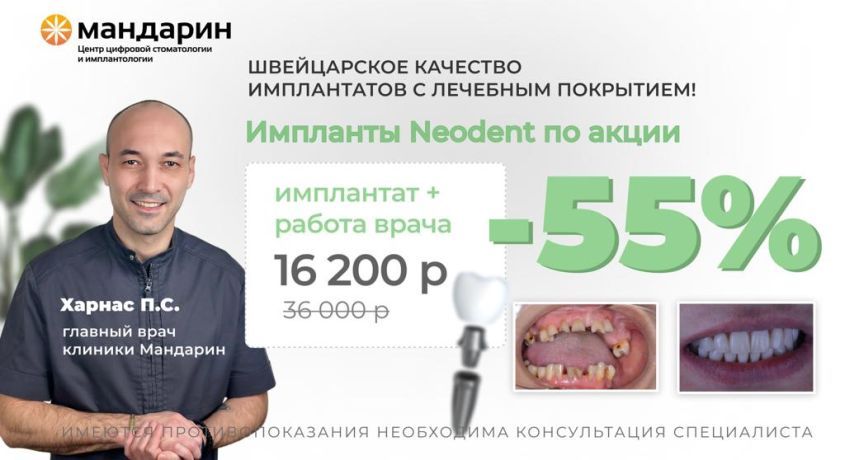 Выгодная акция! Импланты Neodent со скидкой 55% от центра цифровой стоматологии и имплантологии «Мандарин».