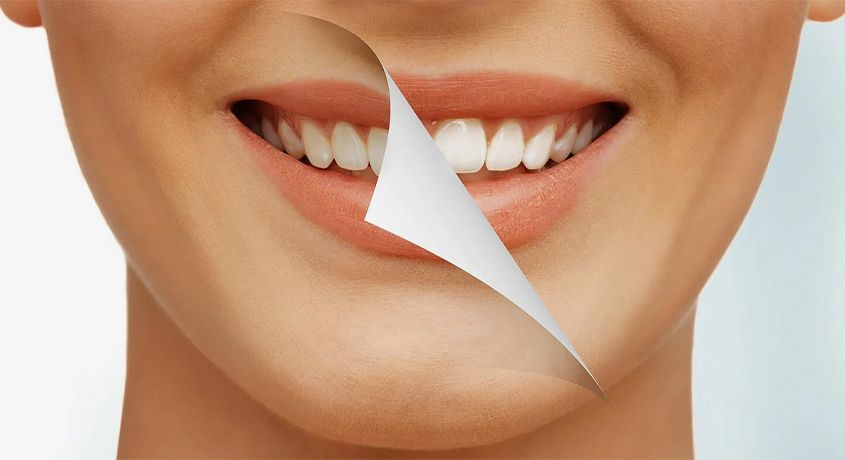 Красивые белоснежные зубы в кратчайшие сроки! Скидка 50% на отбеливание Amazing White в стоматологическом центре «Улыбка».