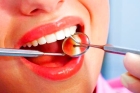Лечение пульпита 4-канального зуба