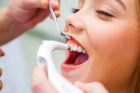 Снятие зубных отложений У3 (1 челюсть)