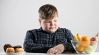 Лечение ожирения 3 степени у детей