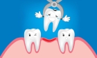 Удаление молочных зубов