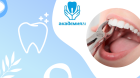 Удаление зуба простое (1 корневого)