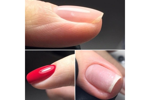 Выравнивание ногтей с покрытием гель-лак