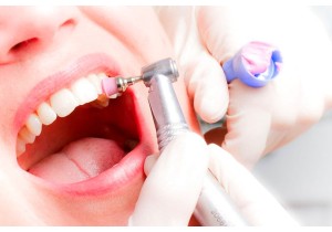Удаление зубного камня ультразвуком (вся полость рта)