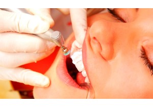 Снятие зубного налета и полировка зубов (1 зуб)