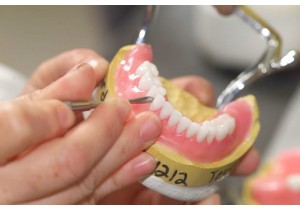 Изготовление нейлонового протеза частичного съемного (на 1 зуб)