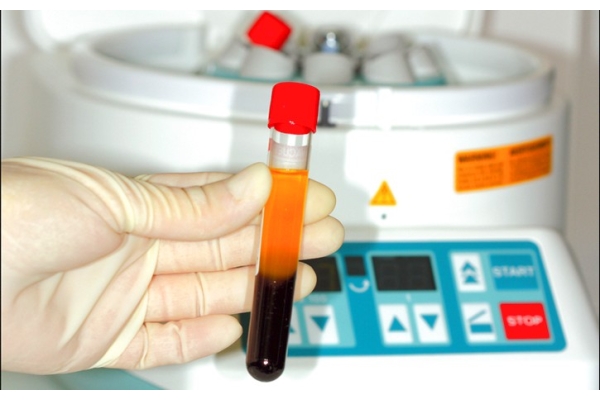 Использование центрифуги (центрифугирование крови), (2 пробирки)