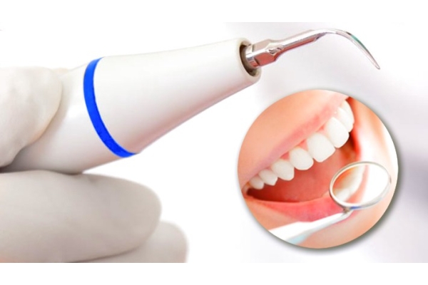 Удаление зубного камня ультразвуком (1 зуб)