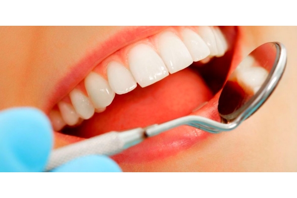 Снятие зубного налета и полировка зубов (вся полость)