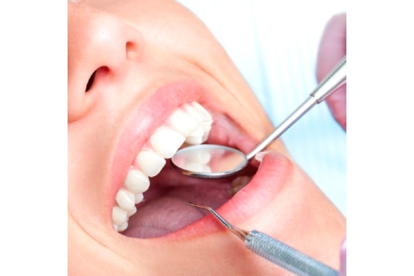 Чистка зубов комплексная