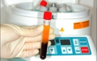 Использование центрифуги (центрифугирование крови), (2 пробирки)