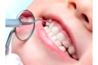   Лечение молочных зубов у детей