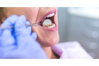 Профессиональное отбеливание зубов