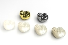 Восстановление зуба коронкой штампованной