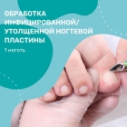 Обработка инфицированной/утолщенной ногтевой пластины (1 ноготь)