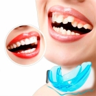 Трейнеры для зубов взрослым 