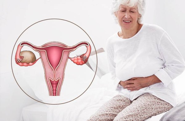 Лечение эндометриоза  у женщин после 40 лет