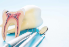 Лечение пульпита 1 канальный зуб 