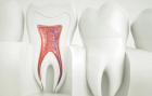Лечение пульпита 4 канальный зуб 