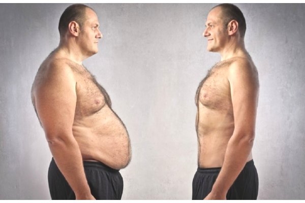 Лечение ожирения у мужчин онлайн
